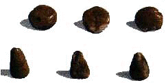 calculi1.jpg (5375 octets)